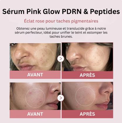 Sérum Pink Glow PDRN